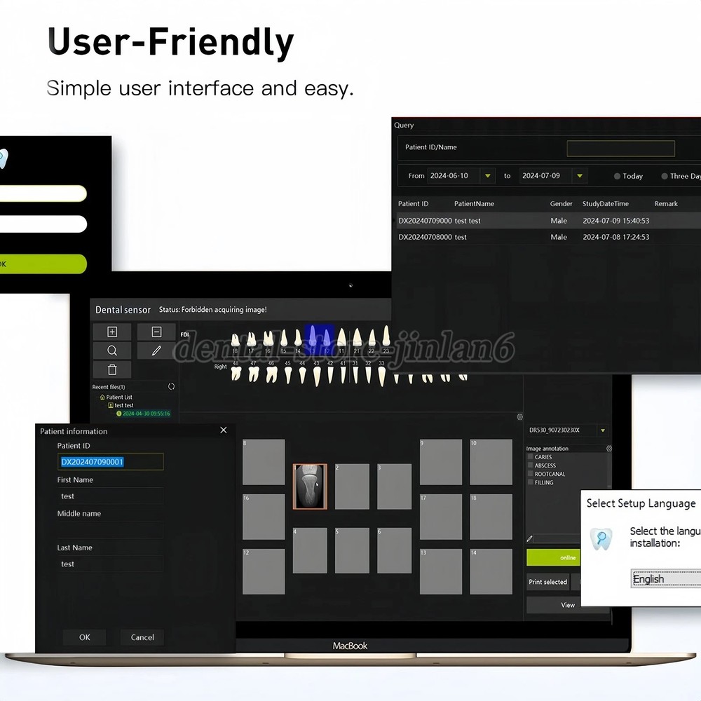 Dental Sensor Unit digital Sensor Image HD Sensor Size 1.5(TWAIN Drive Compact)