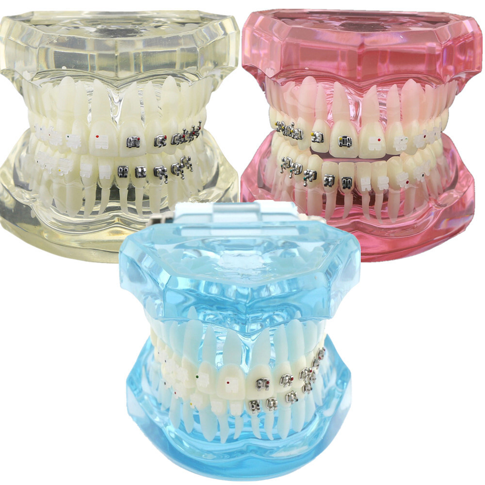 Dental Teach Study Typodont Teeth Model Half Metal Bracket Half Ceramic Bracket