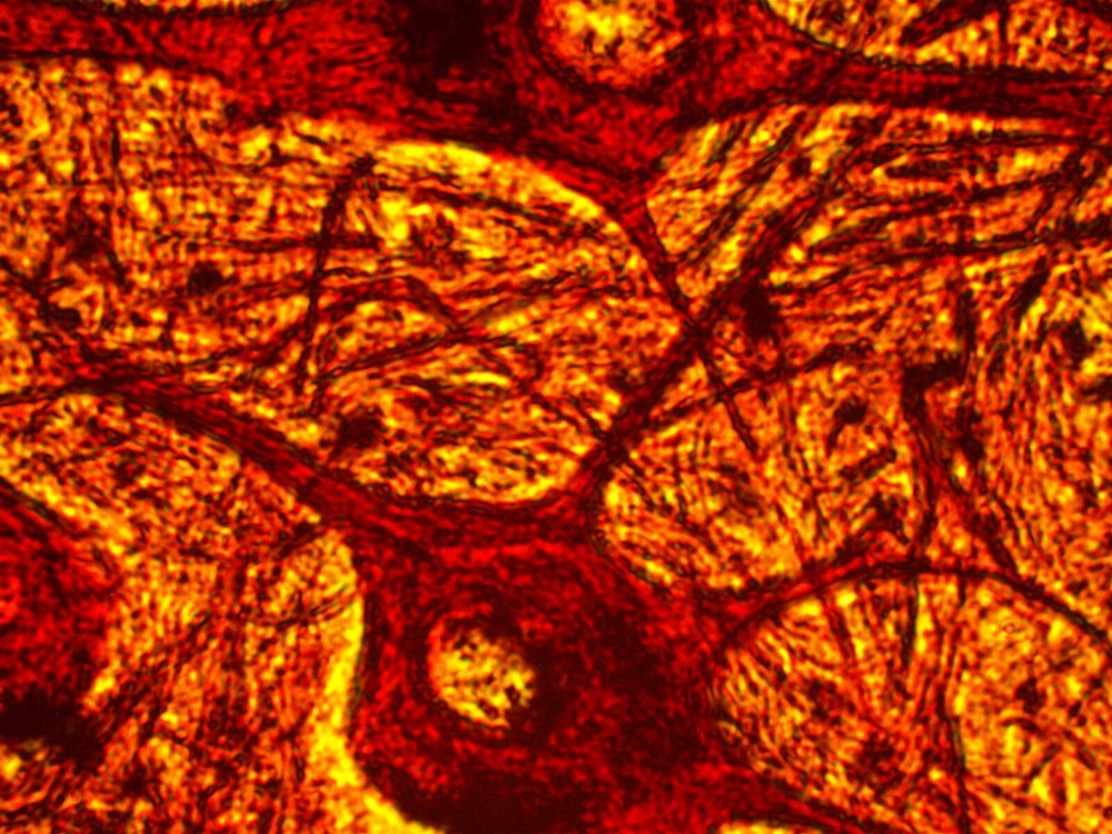 *Sale* Reconditioned AO Compound Microscope, 100X, 430X!