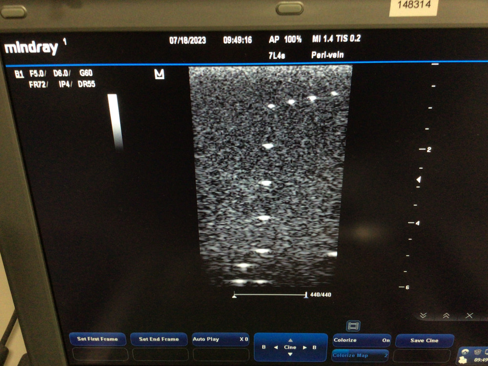 2018 Mindray 7L4s Linear Array Ultrasound Probe