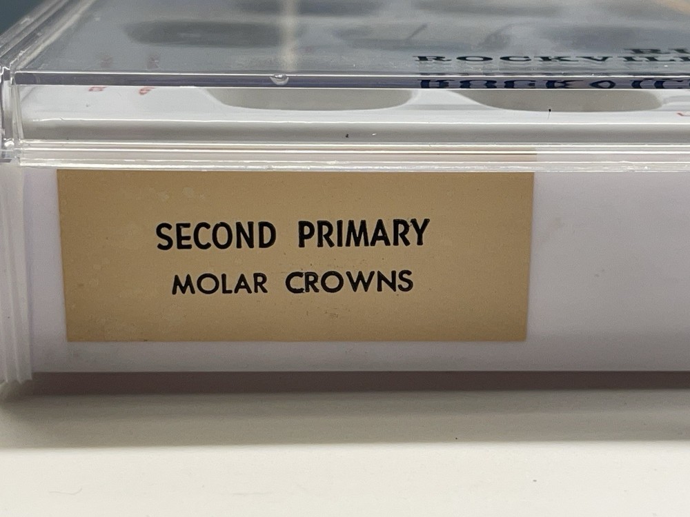 Second Primary Molar Crowns by Rugby Labs