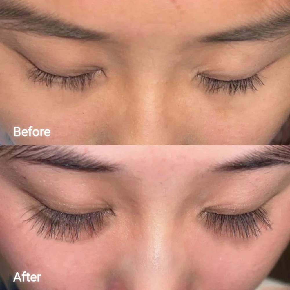 Eyelash Growth Serum Natural – Longer Thicker Lashes Fast – Lash Enhancer