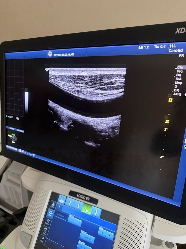 2017 GE 11 L D Probe Excellent working condition