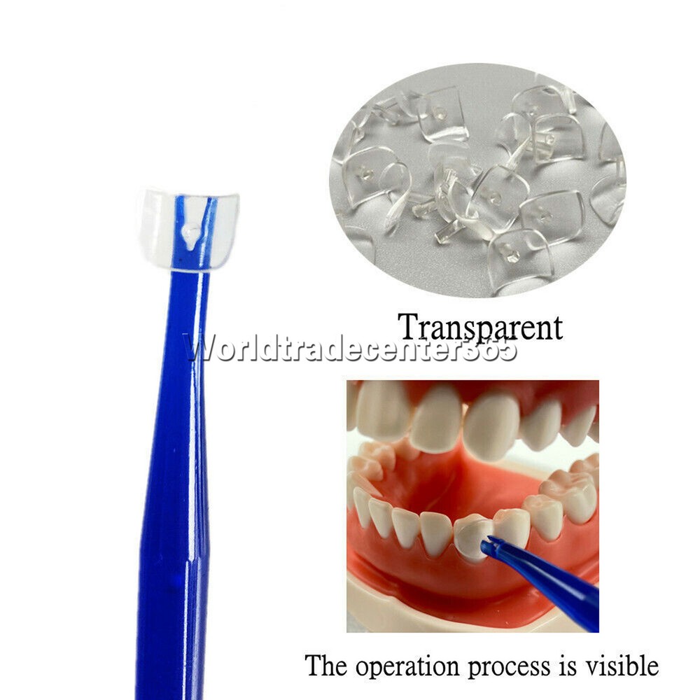 Dental Transparent Cervical Matrices Retractor Matrix Composite Gingival Veneer