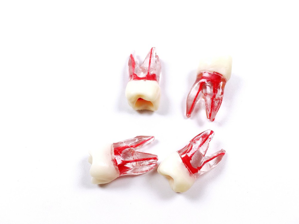 Dental Endo Root Canal File Training Study Model Student Practice Block Red Pulp