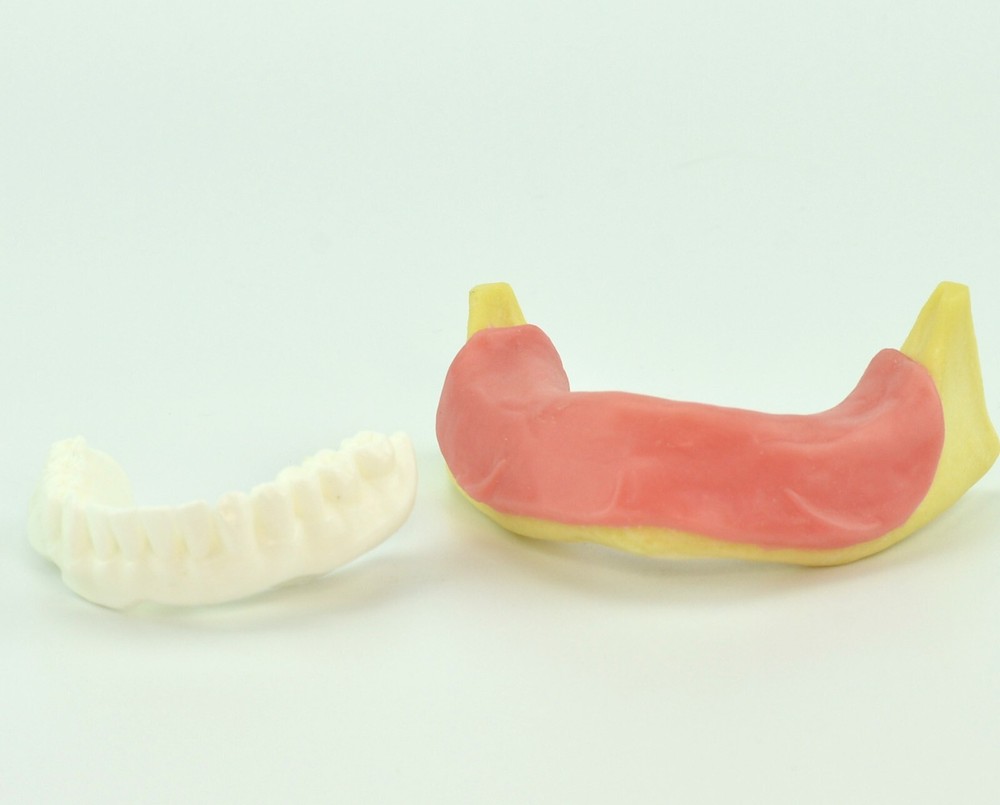 Dental Mandibular Implant Plus Denture Training Model Implant Placement