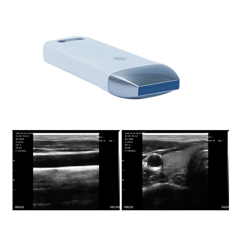 Portable 80 Elements Linear Array Wireless Ultrasound Probe Multi-OS Compatible