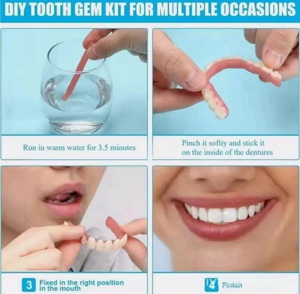 Custom-Fit DIY Denture for S/M Upper