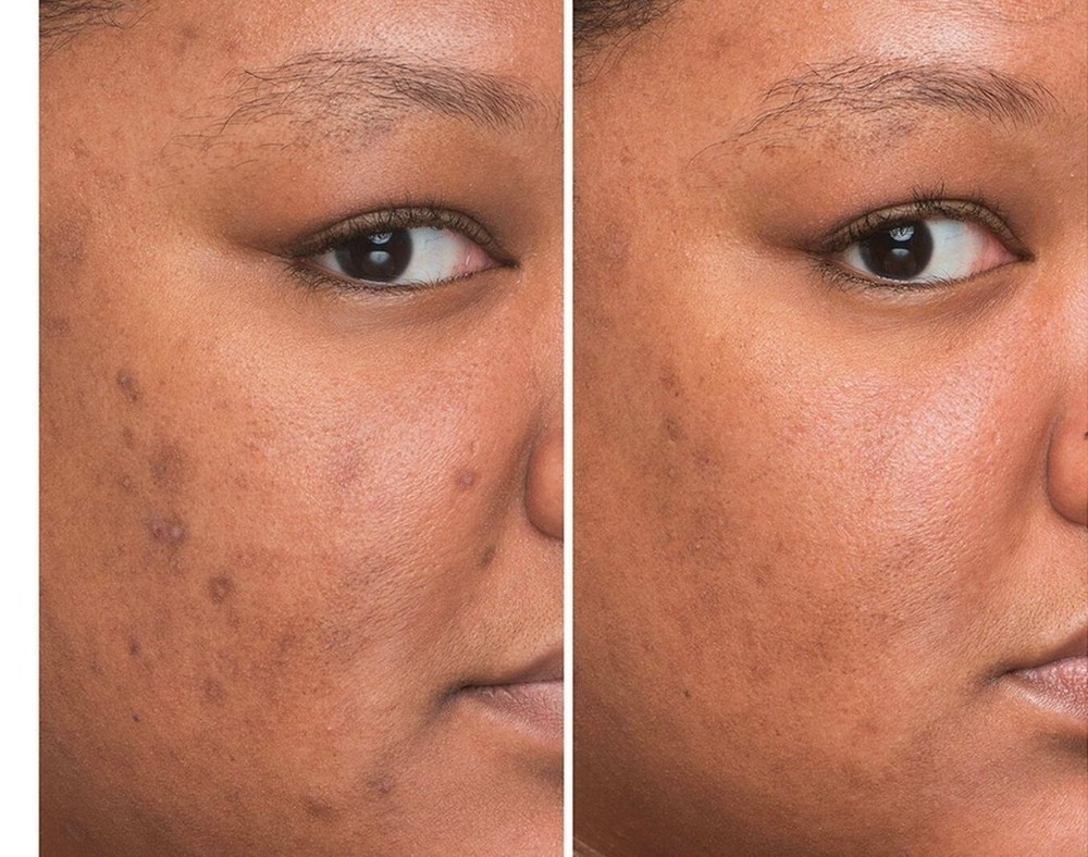 IT cosmetics Bye Bye Dark Spots