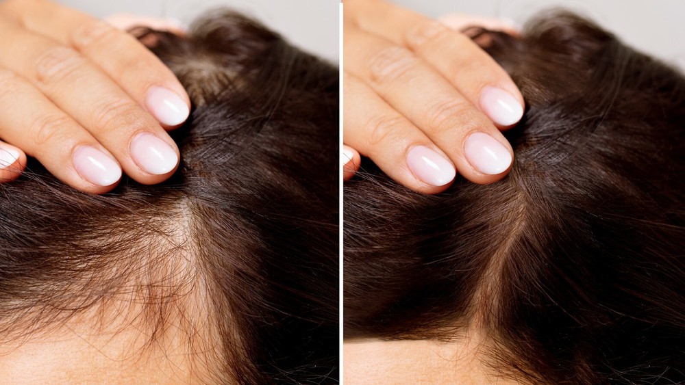Hair Increase Spell