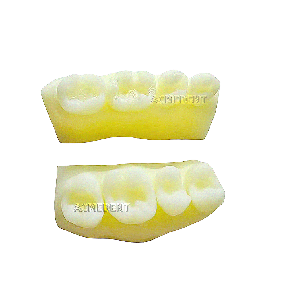 Dental Caries Decay Teeth Model Tooth Simulate Class Ⅱ Resin Restore Template