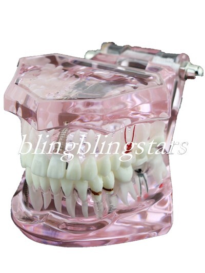 Dental Implants Training pathologies & techniques Pathological Disease Teeth
