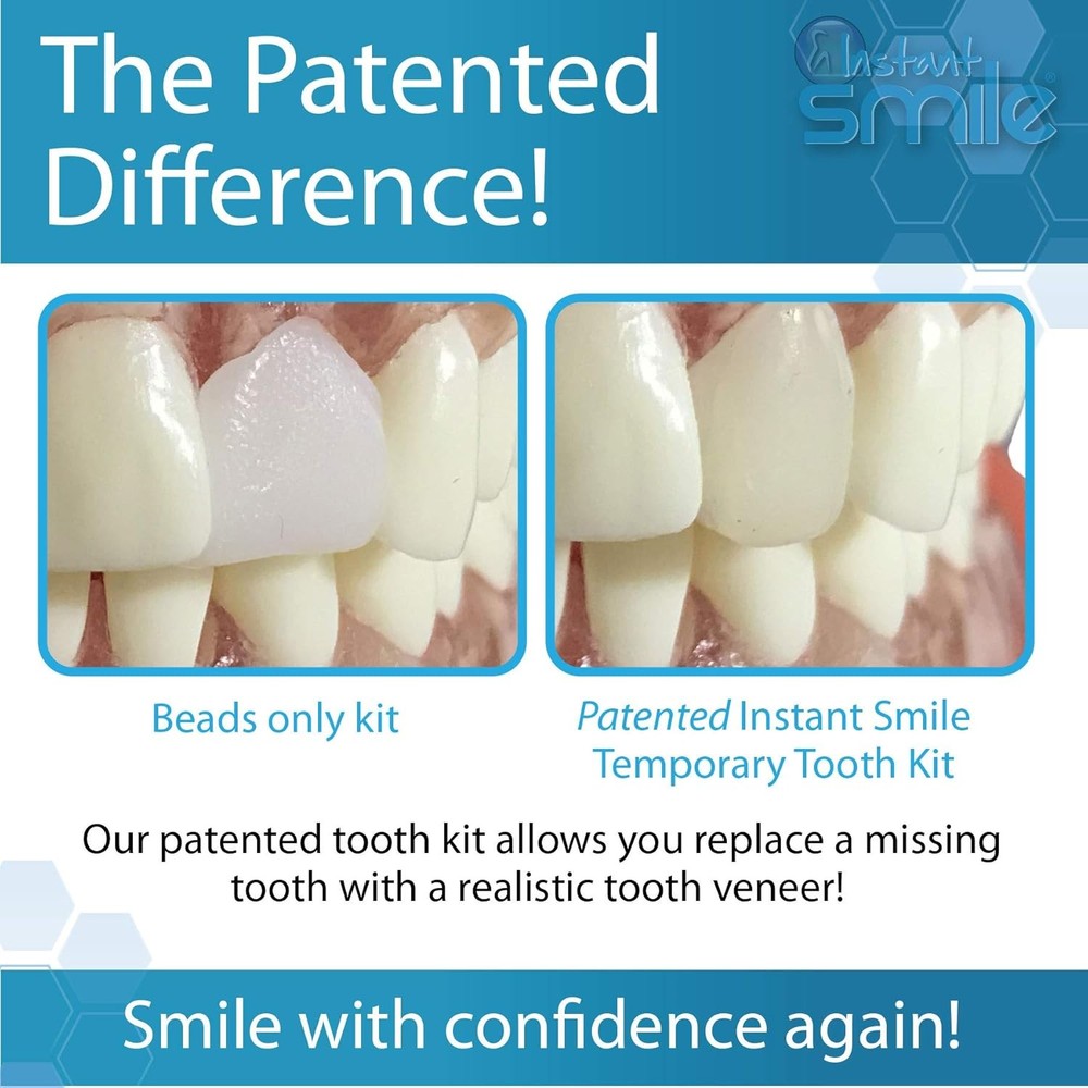 Instant Smile Complete Your Smile Temporary Tooth Replacement Kit - Replace a Mi