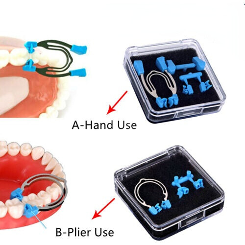 Dental Matrix Sectional Contoured Matrices Clamps Spring Clip Rings A/B Type