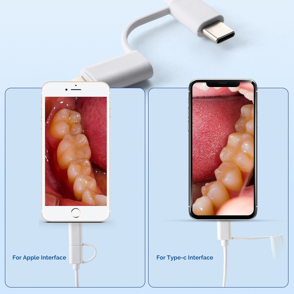 Dental High Resolution Interface Intraoral Camera 8 White Cold Light LEDs USB