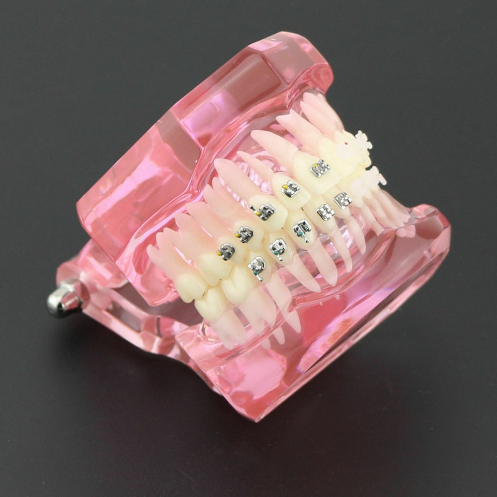 Dental Orthodontic Teeth Model Self-ligating ChainMetal Ceramic Bracket