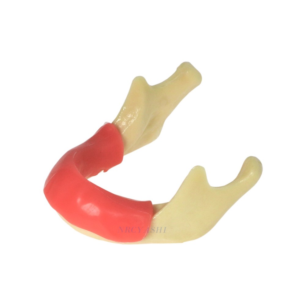 Dental Mandibular Implant Model - Jaw With Gum Simulation Bone Drilling Practice
