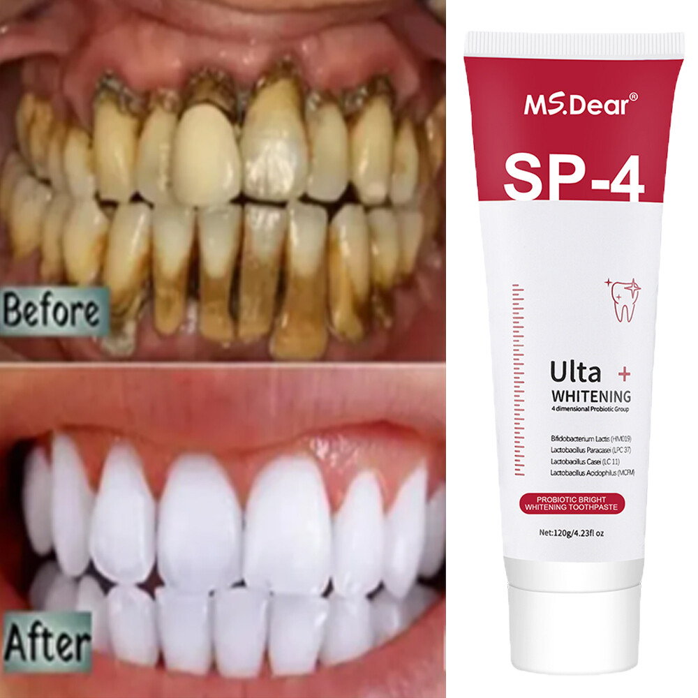 3Pcs SP-4 Probiotic Toothpaste, Sp-4 Toothpaste Whitening ,Remove yellow teeth