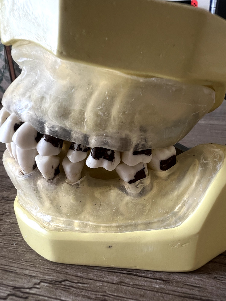 Nissin Periodontal Typodont Includes Both Upper And Lower Arch