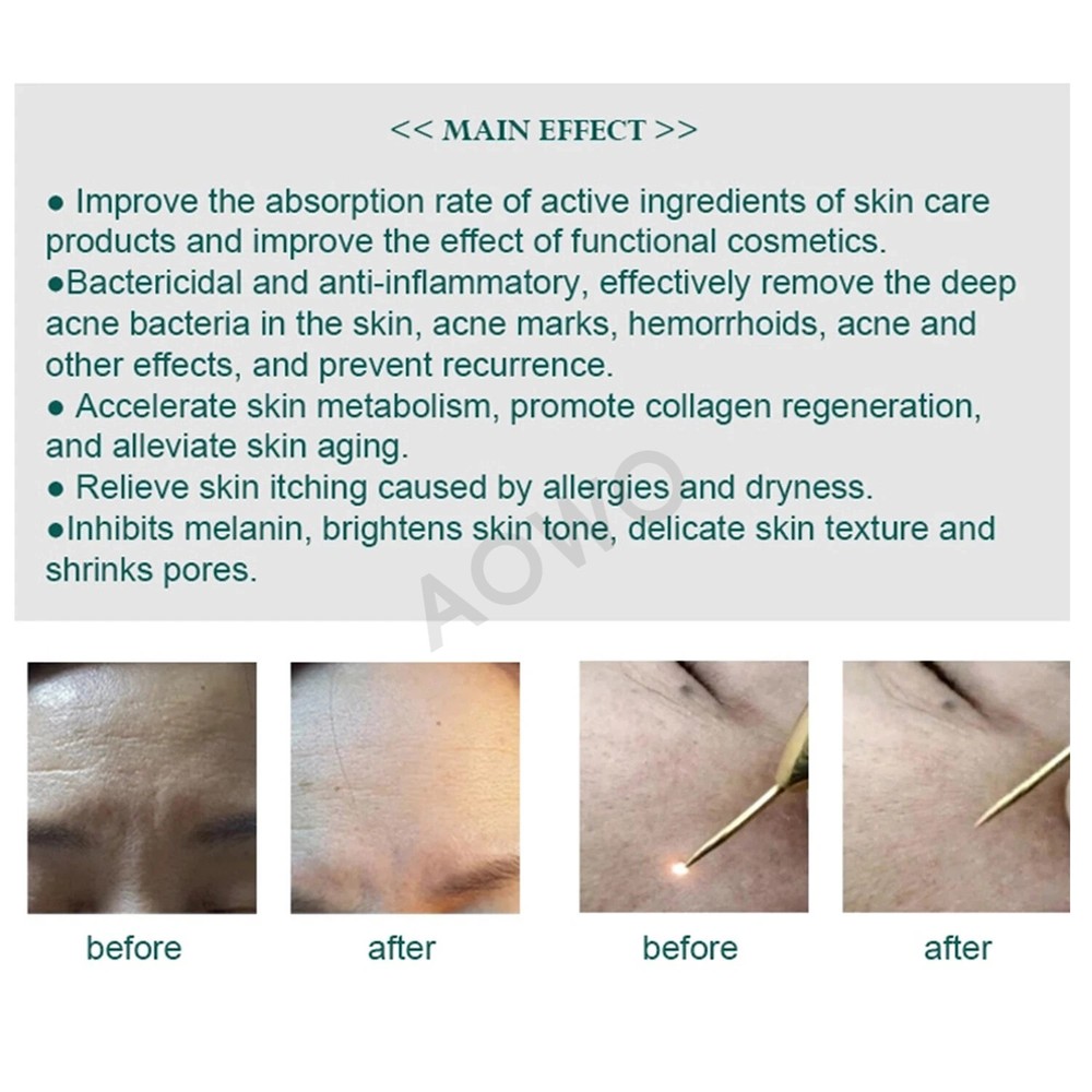 Advanced Plasma Pen for Spot Removal for Skin Eye Lift Functionality Acne Remove