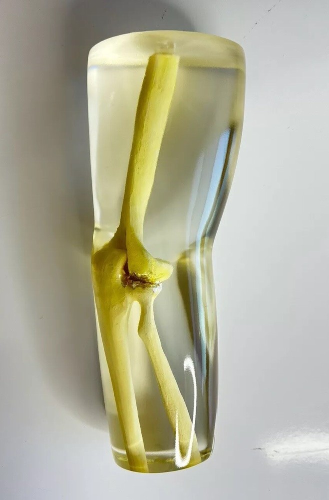 RSD Phantoms Natural Transparent Mannequin Elbow (Testing & Calibration)