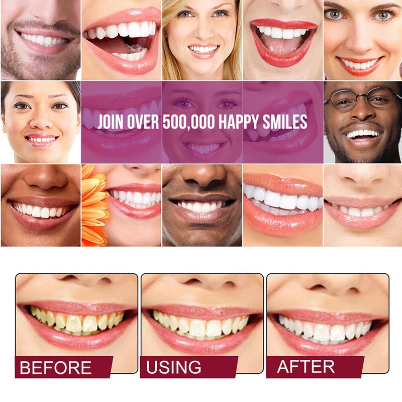 3PCS SP-6 Probiotic Toothpaste,Sp-6 Toothpaste Ultra Whitening Teeth Quick White