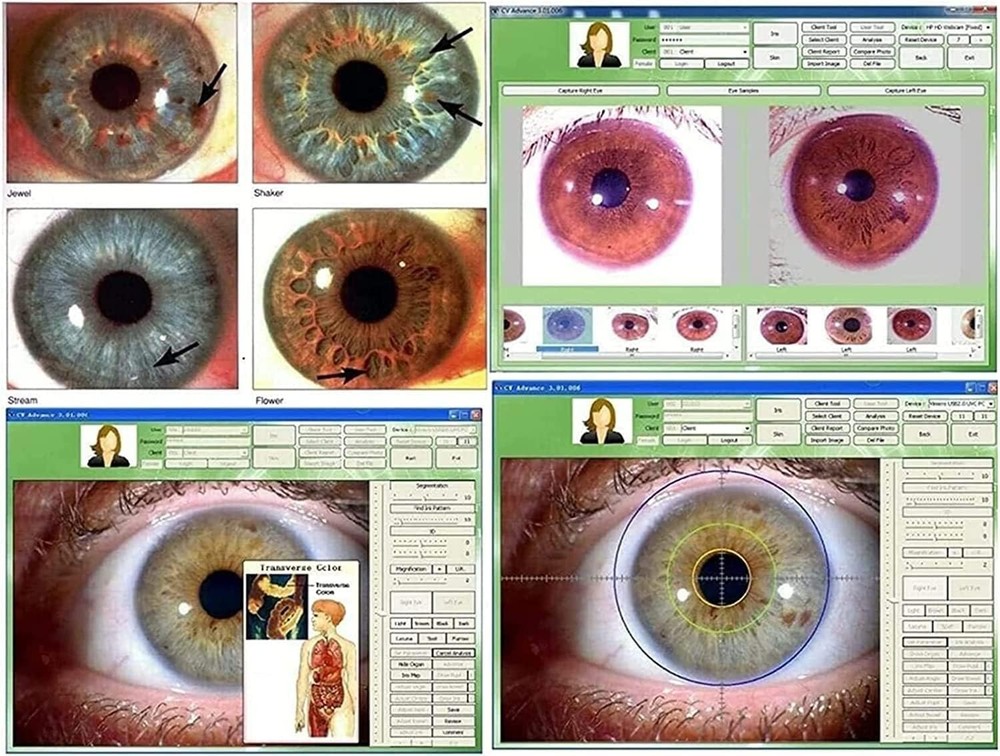 Iris Analyzer Iridology Camera Body Health Analysis Camera with Iris Software US
