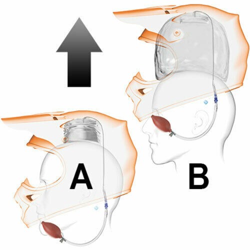 Simpson Helmets 890-01-30 Eject Helmet Removal System