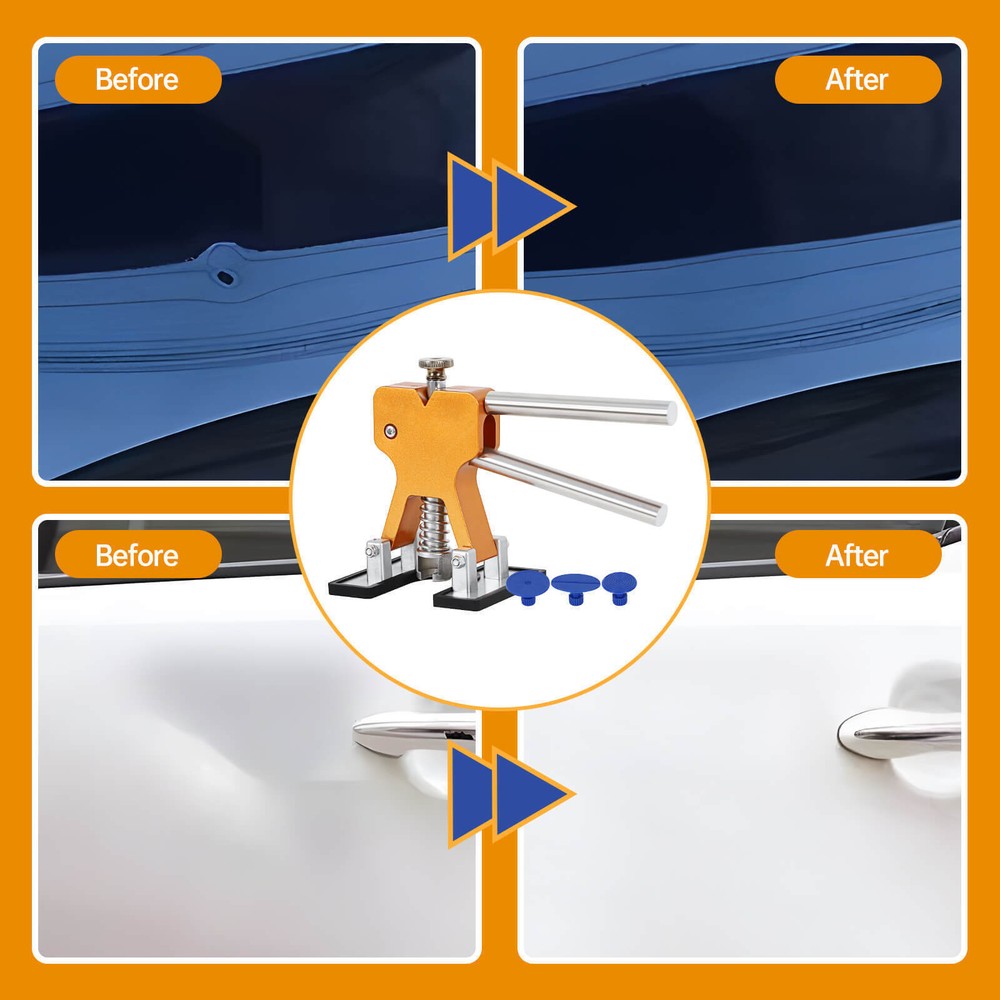Paintless Car Body Dent Puller Repair Tool Dint Hail Damage Remover Kit