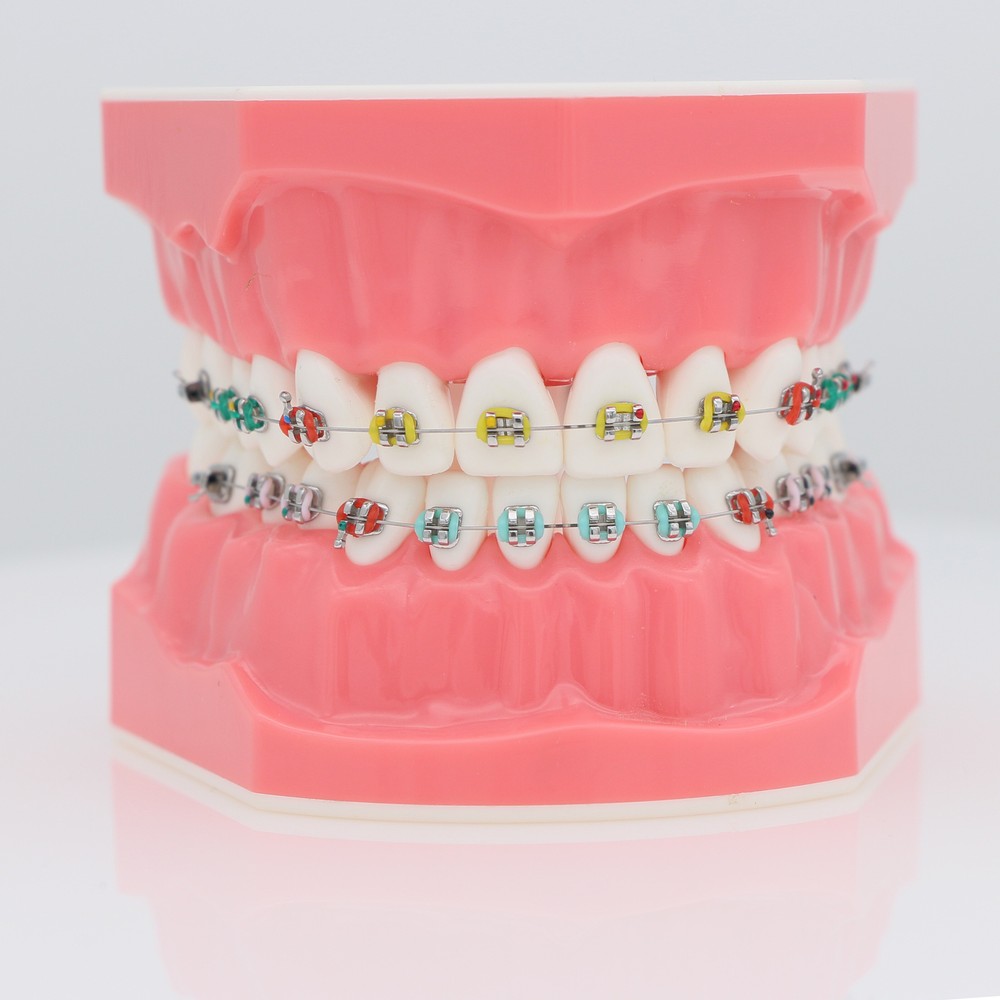 Dental Orthodontic Teeth Model Typodont Demonstration Model with Brackets