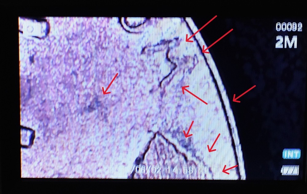 1949 D Penny Error Red Mint State Multi Error Double Die, Cracks Collar Filled D