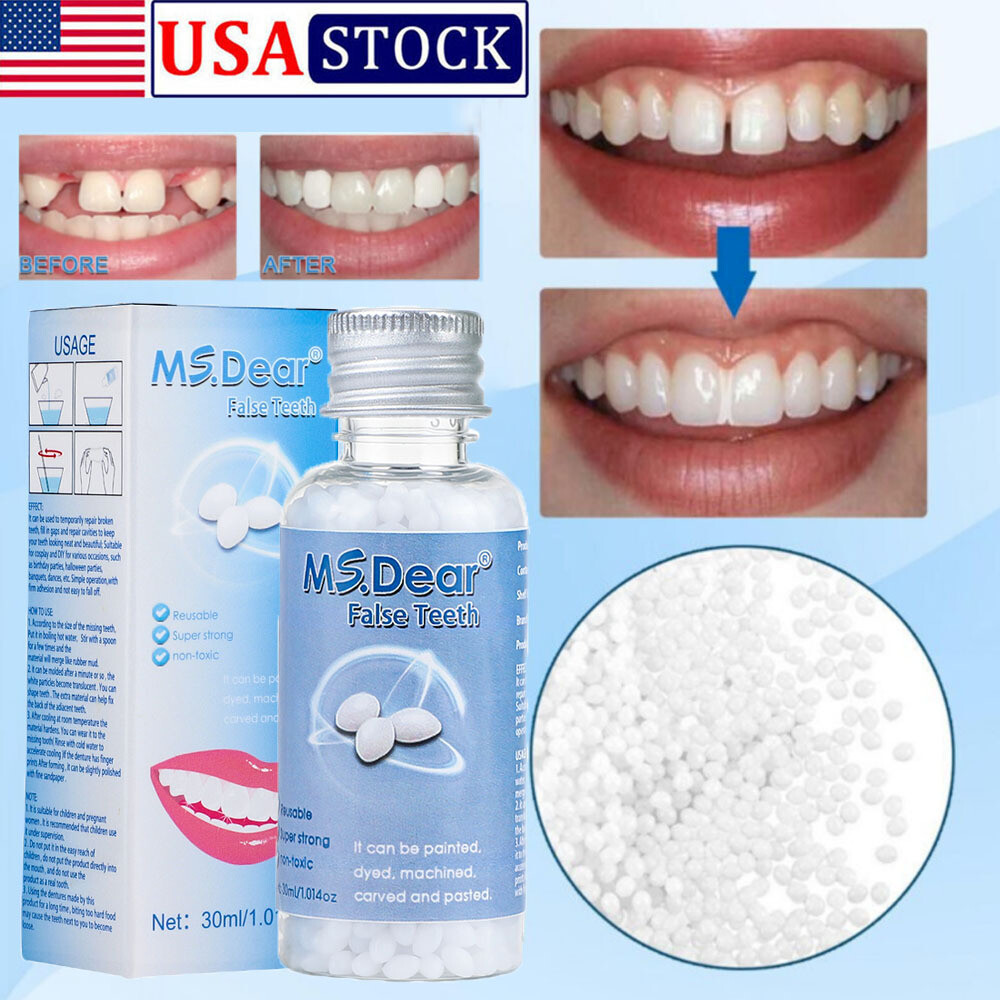 Tooth Repair Kit - Temporary Teeth Replacement Kit for Missing & Broken Teeth US