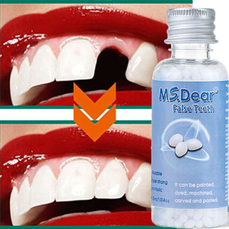 Tooth Repair Kit - Temporary Teeth Replacement Kit for Missing & Broken Teeth