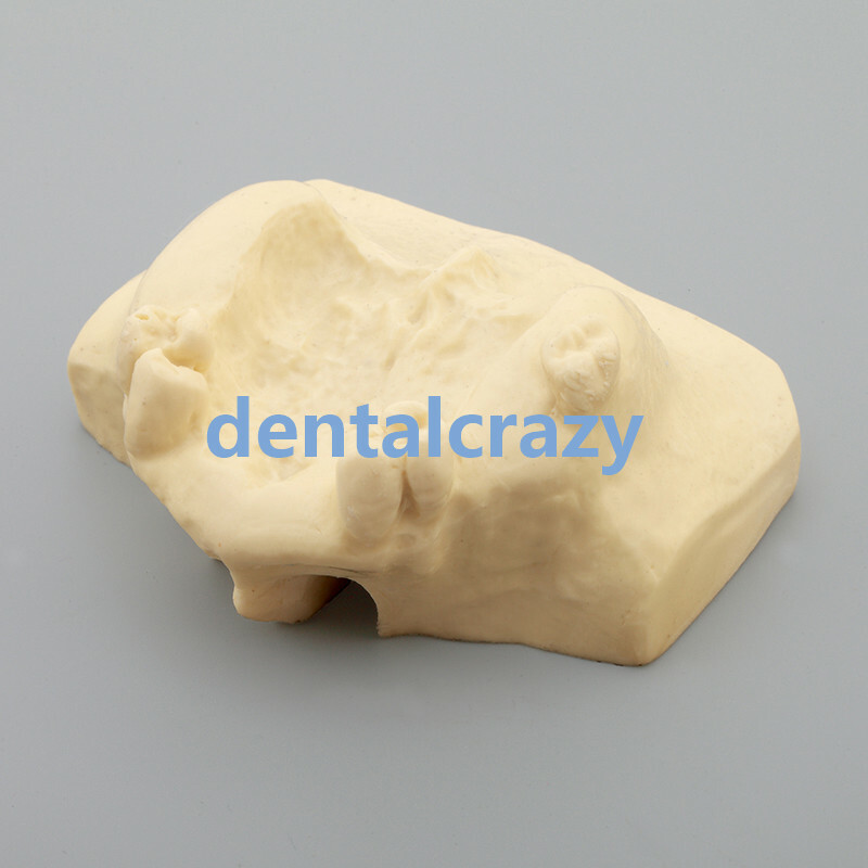 Dental Sinus Lift Practice Teeth Model Typodont Study Model 2013F