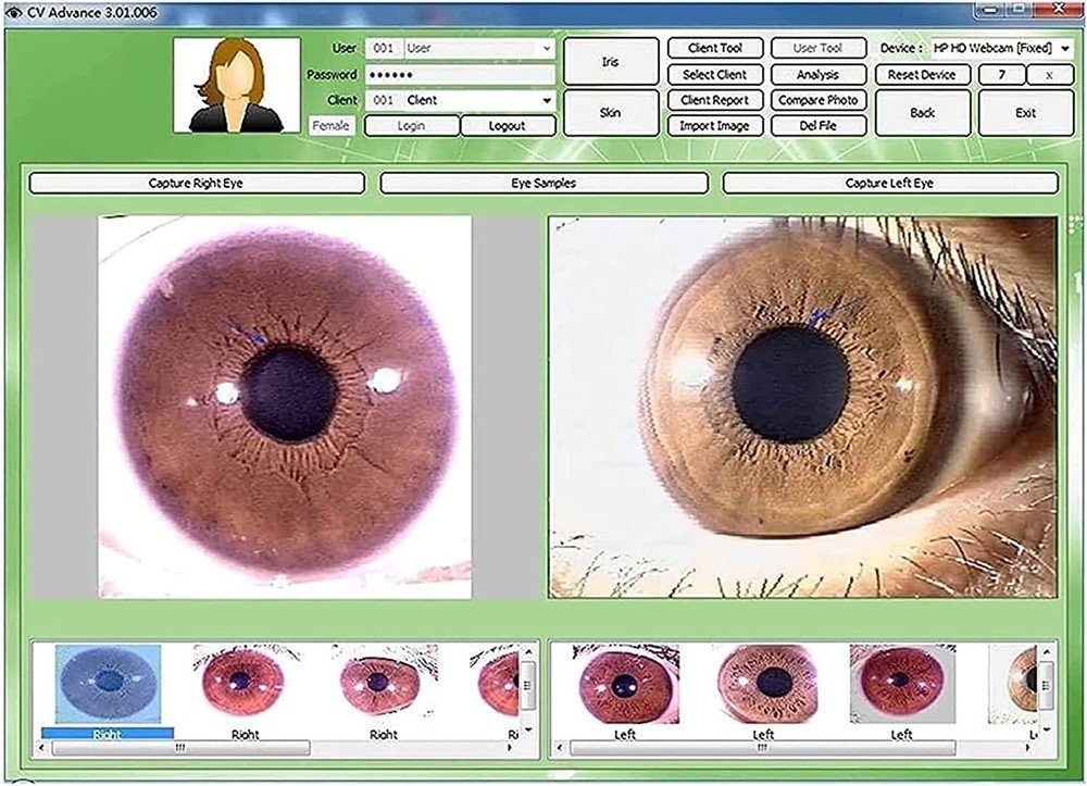 Iris Analyzer Iridology Camera Body Health Analysis Camera with Iris Software US