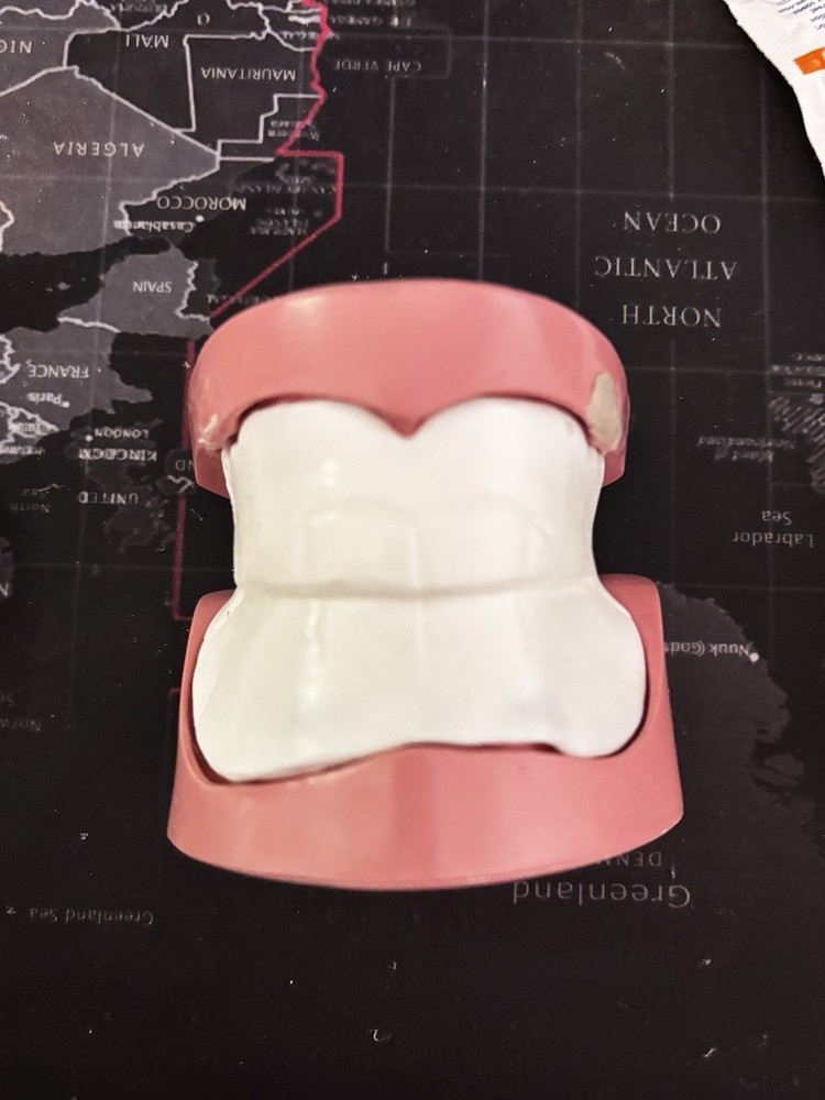 acadent edentulous Typodnont Acadent