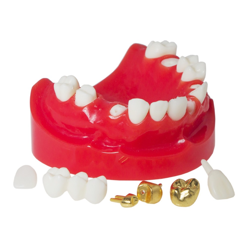 Dental Teaching Typodont Teeth Restoration Model Crown Post Core Bridge M6004