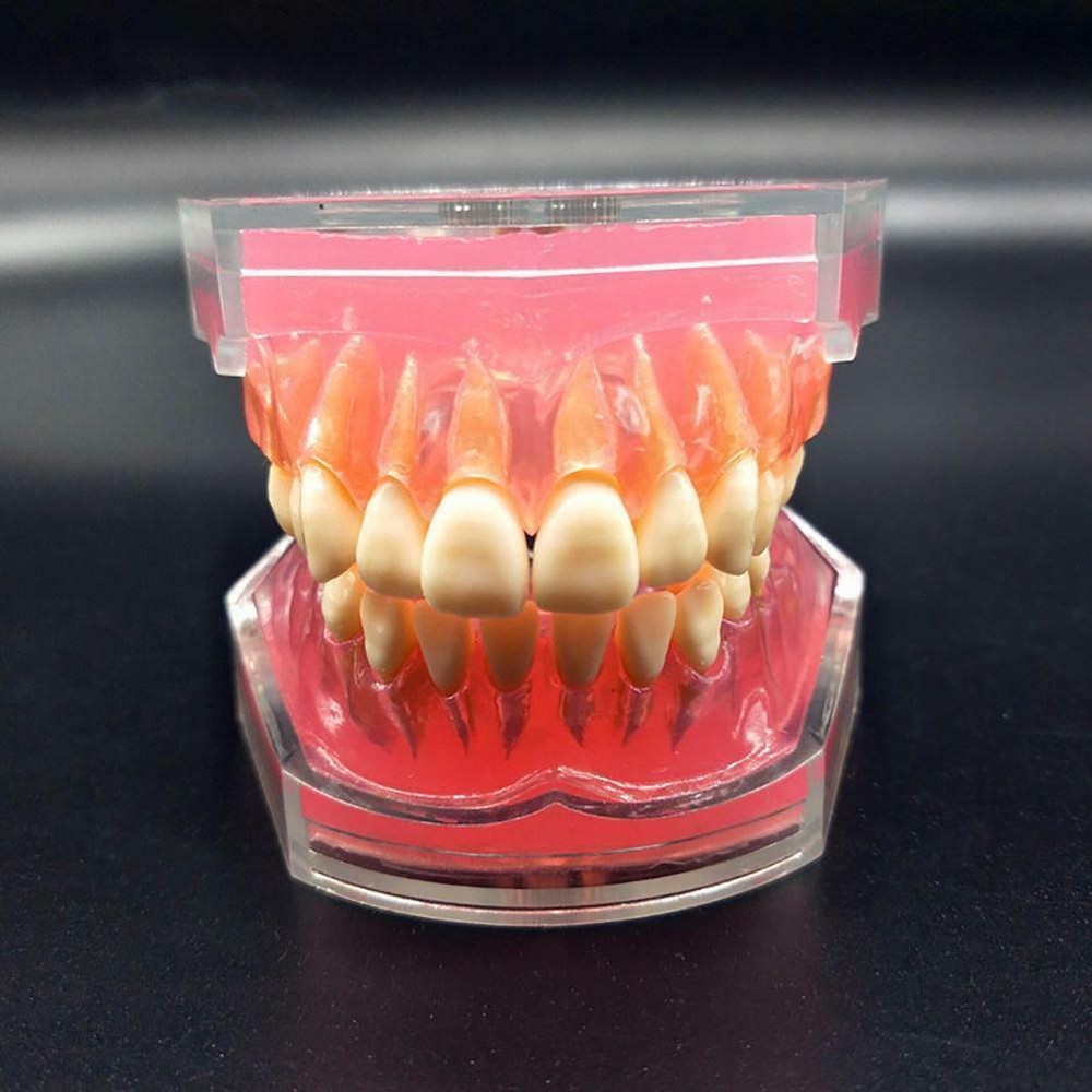 Dental Orthodontic Typodont Plastic Teeth Model 4004 Removable Teeth Standard