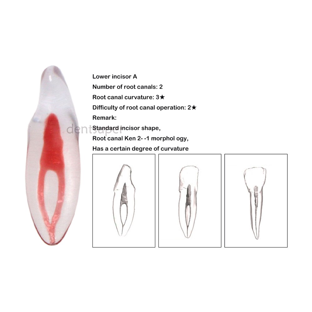Dental Endo Root Canal Teeth Model Practice Block for RCT Pulp Cavity Study, 3D