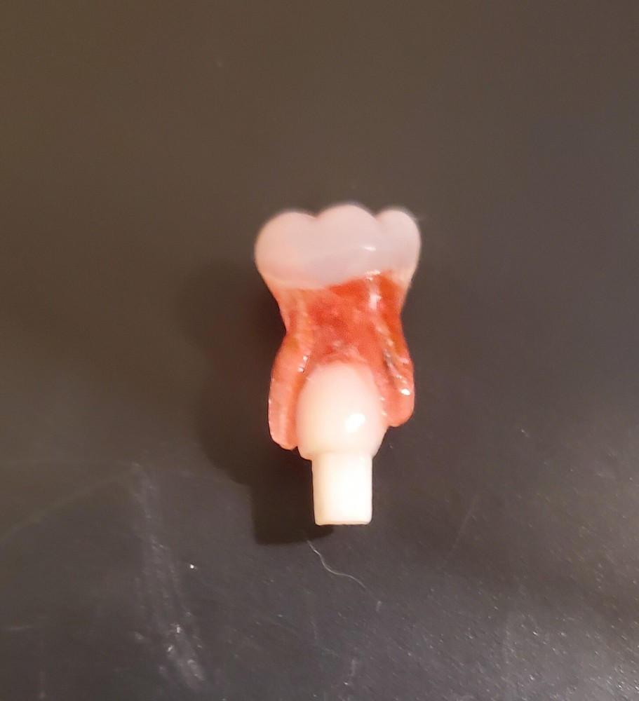 Acadental Endo 3DP Tooth #K