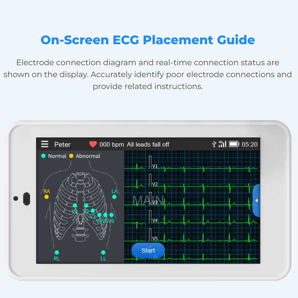 12-Lead ECG Machine Diagnostic Automatic Interpretation data transfer via email