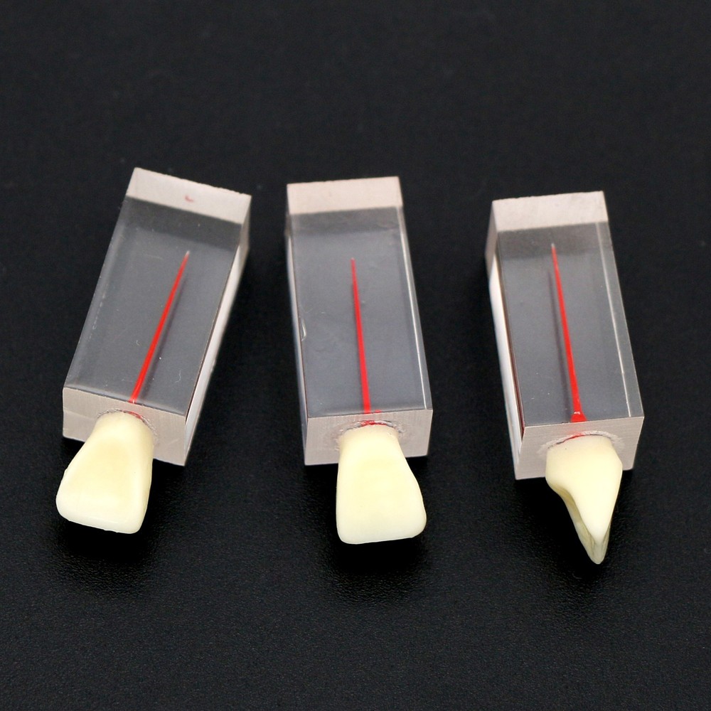 5Pcs Dental Root Canal Teeth molar Model Study Practice For Endodontic Pulp File