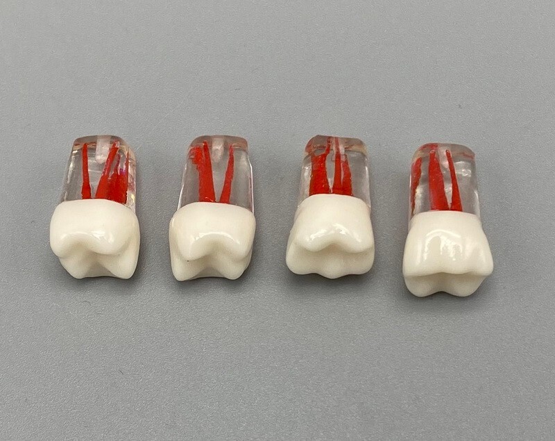 5pcs Dental Root Canal Teeth Study Practice Model Endodontic RCT Endo Pulp File