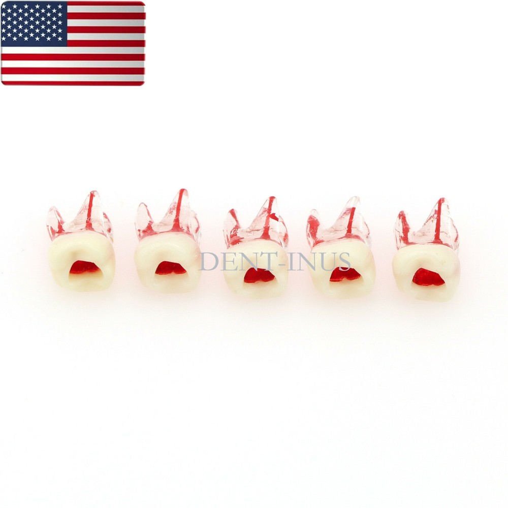 US Dental Endo Molar Root Canal Study Practice Block Pulp Cavity Model RCT/MTA