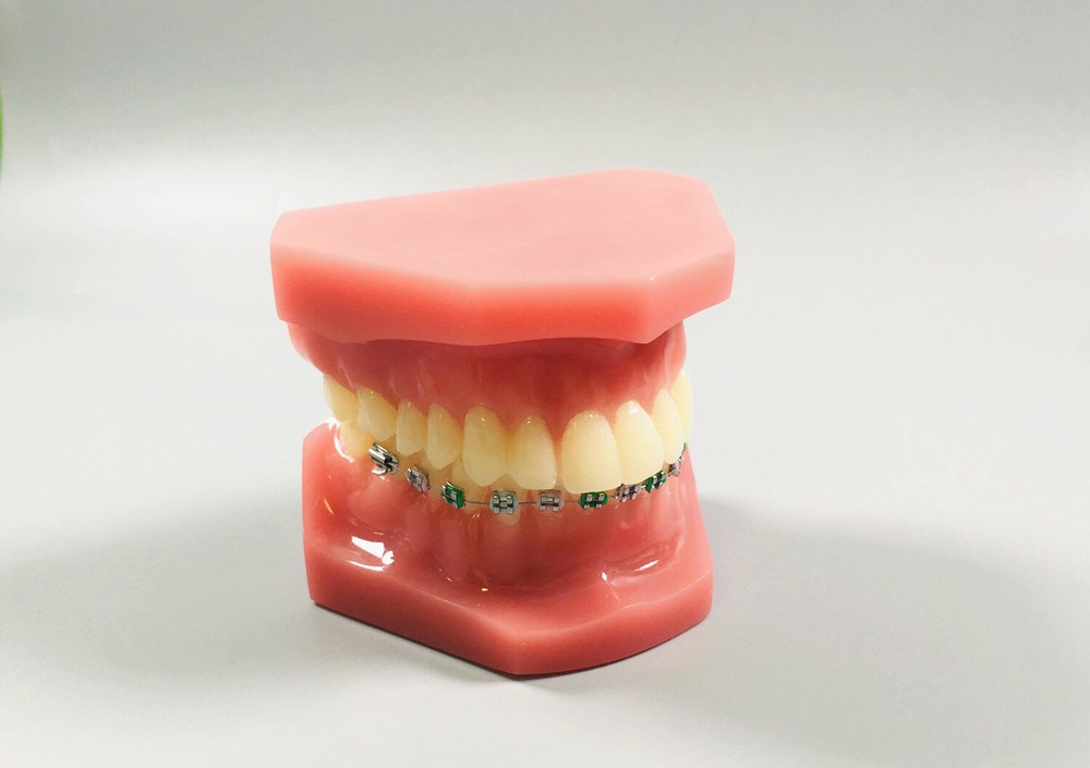 1Pc Dental Model Invisible Retainer Metal Brackets Contrast Aligner Comparison