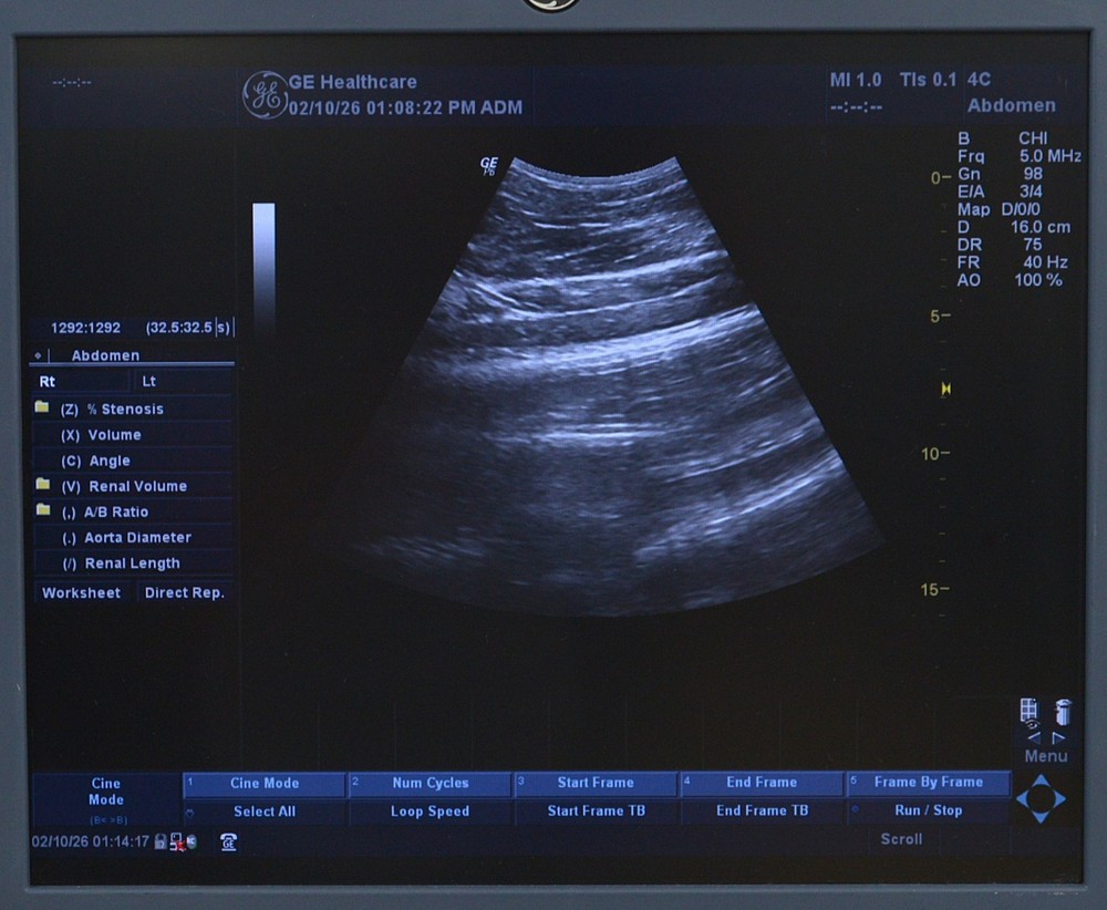 GE 4C 2401359 Convex Array