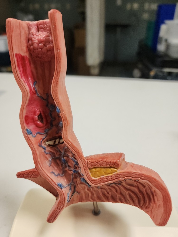 Anatomical Model Of Esophagus