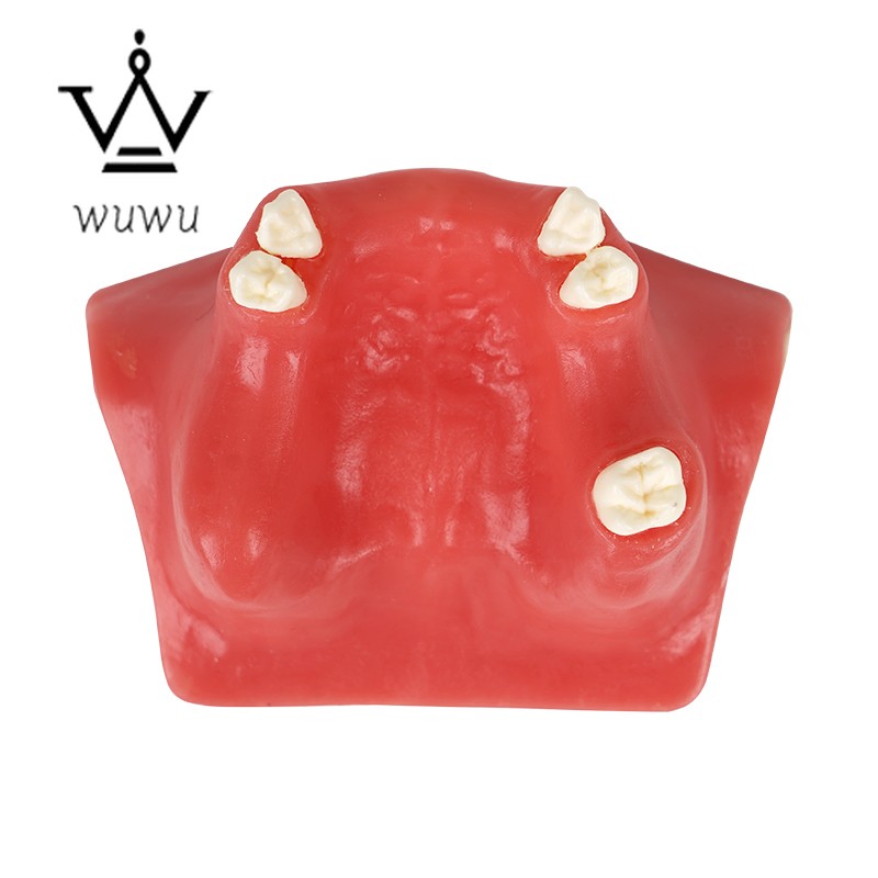 Dental Implant Teaching Model Upper Jaw Maxillary Sinus Model