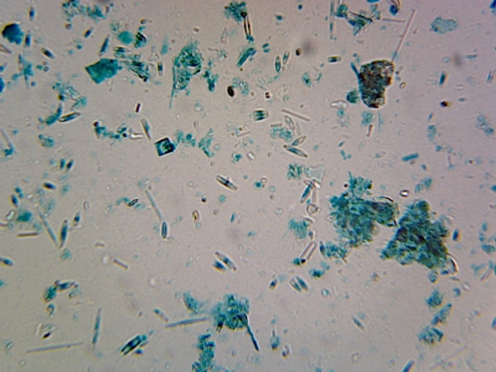 Diatomeae (Comparing Various Mixed Diatoms); Whole-mount