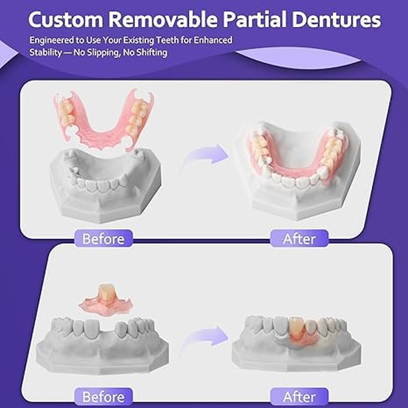 Custom Partial Dentures for Missing Teeth Removable Personalized Replacement Sol